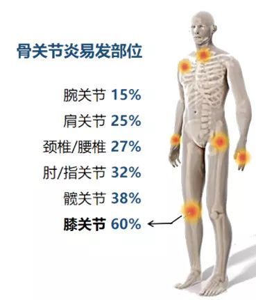 什么是OA？-宽田-博客园